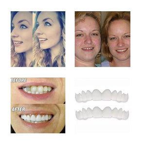 1 SET OF DIAMOND SMILE VENEERS (TOP & BOTTOM TEETH)