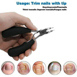 （50%OFF TODAY）  Medical-Grade Nail Clippers