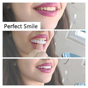 1 SET OF DIAMOND SMILE VENEERS (TOP & BOTTOM TEETH)